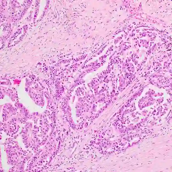 papillary carcinoma of breast package package test